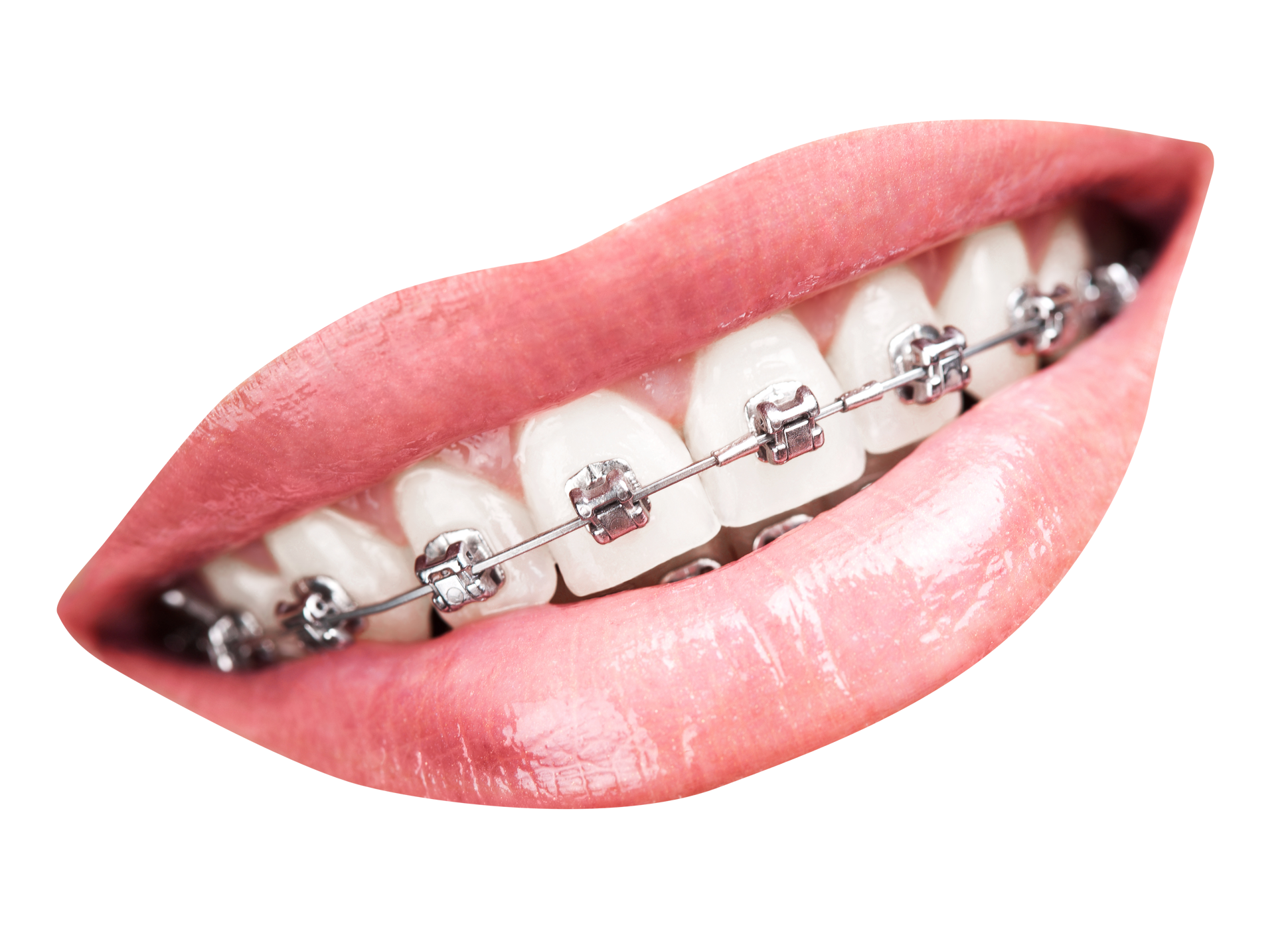 dent10