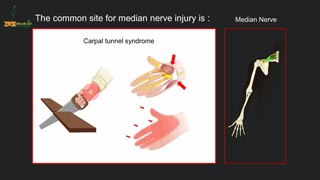 Madian Nerve