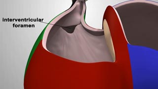 Septation of Aorticopulmonary canal