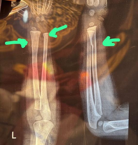 كلية الطب بجامعة أسيوط تنظم قافلة طبية متكاملة بإسنا لعلاج أكثر من 4000 حالة بالتعاون مع البنك العربي الأفريقي